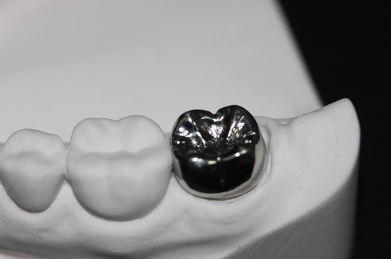 Puente dental natural de la corona de la estabilidad del color FDA resistente a la corrosión