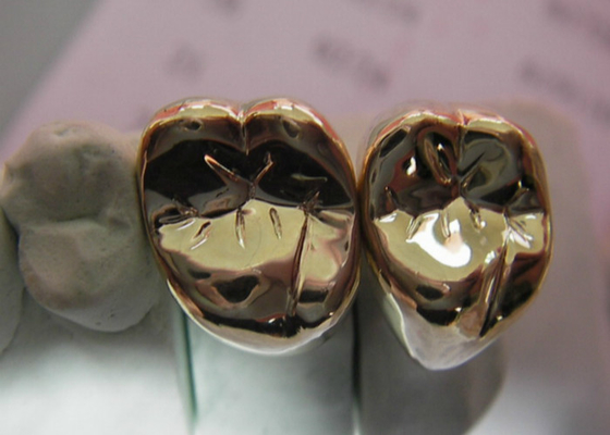 Corona de alta resistencia del metal semi precioso del diente de la corona del metal de FMC