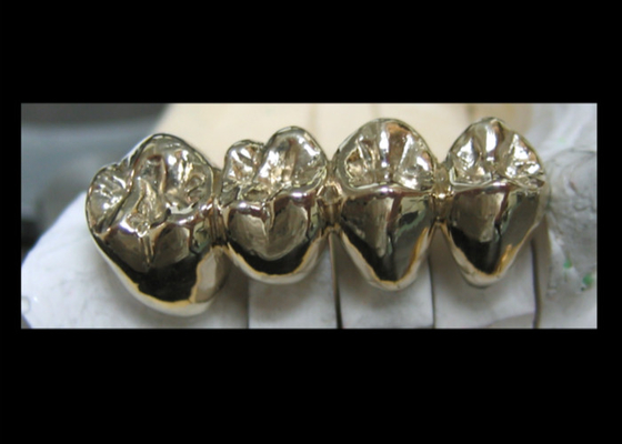 Ultra difícilmente el OEM que pule el puente dental de la corona mancha resistente