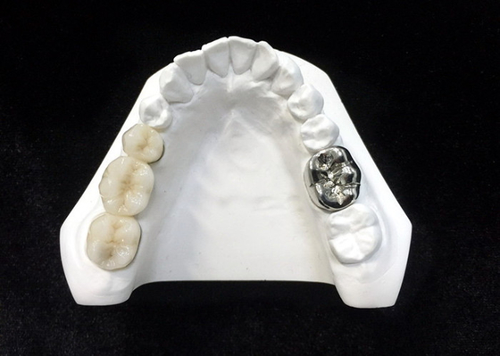 Alta densidad dental de la seguridad de la salud de la corona de la porcelana ultra dura de Digitaces