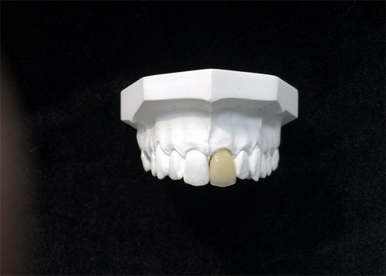 Material biológico de High Tech de la buena de Biocompatibility corona dental de la porcelana