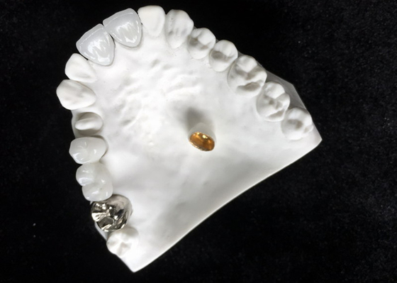 Material biológico de High Tech de la buena de Biocompatibility corona dental de la porcelana