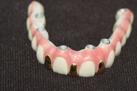 Precisión Digital 3D que imprime el metal de la barra del implante dental basado