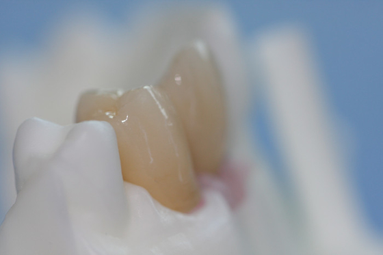 Contrafuerte de encargo del titanio de la barra pura desprendible del implante dental