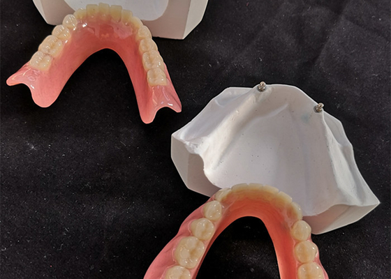 El implante dental cómodo Overdenture de la leva del cad fácil mantiene