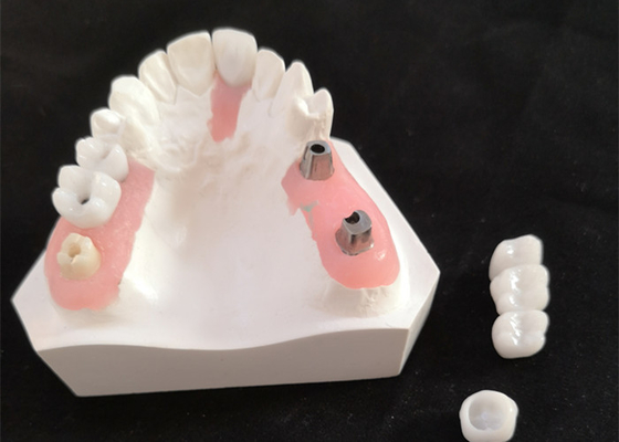 FDA Corona de zirconio con dentaduras con implantes para laboratorio dental