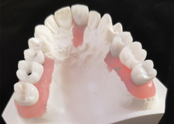 Buena barra inter biológica del implante dental de la miscibilidad con la aprobación del FDA