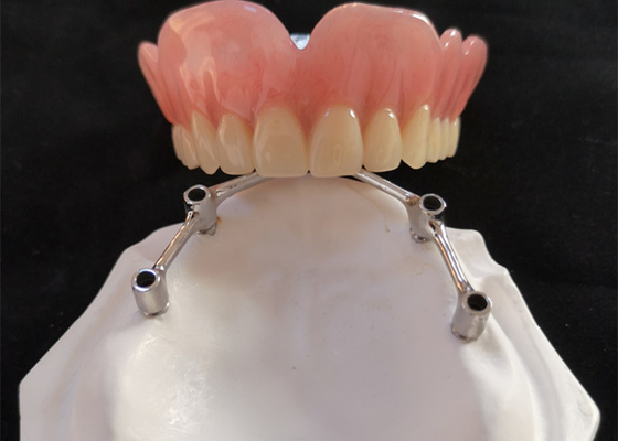 Implantes dentales de la corona FDA del implante del diente de COCR con la barra del titanio