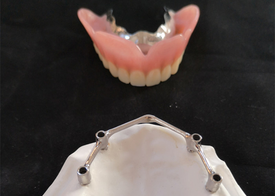 Implantes dentales de la corona FDA del implante del diente de COCR con la barra del titanio