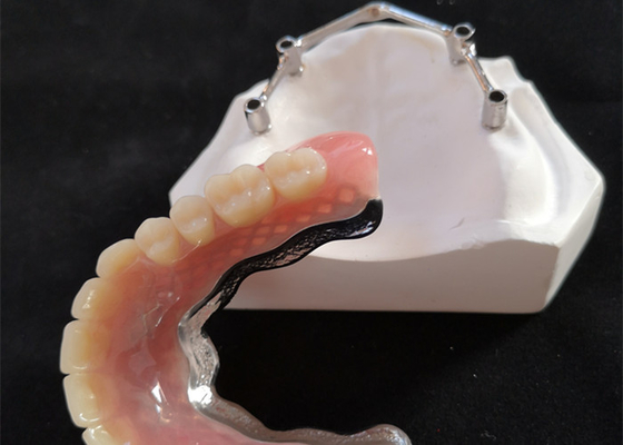 Barras de implantes dentales de titanio/titanio puro para el centro digital CAD CAM