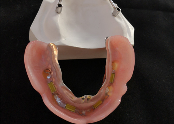 Barras de implantes dentales de titanio/titanio puro para el centro digital CAD CAM