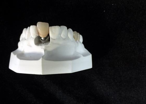 Alta dentadura del accesorio de barra de la estabilidad de los localizadores de encargo del implante dental