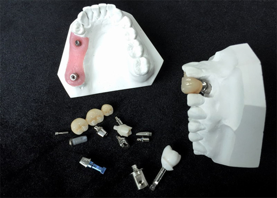 Alta dentadura del accesorio de barra de la estabilidad de los localizadores de encargo del implante dental