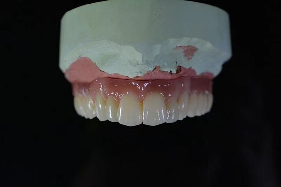 Material biológico de High Tech de la barra del implante dental de la leva de la seguridad cad de la salud