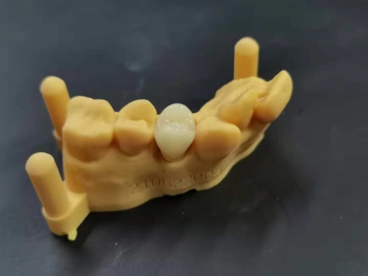 OEM 3D que imprime el diseño dental de Digitaces del laboratorio de la dentadura de acrílico flexible