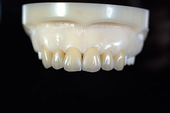 Laboratorio dental de dentadura de zirconia personalizado - Entrega y reparación rápida