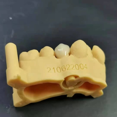 Diseño digital + impresión de modelos + corona de zirconia