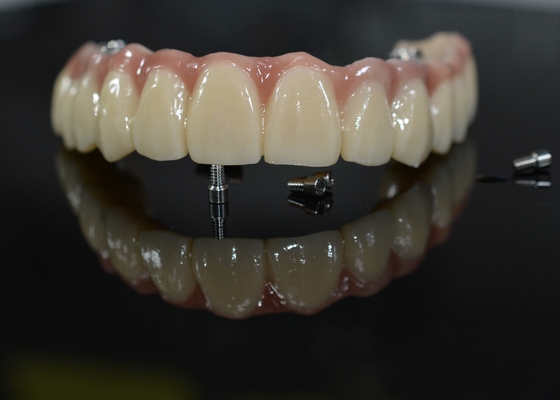 Coronas dentales de zirconia: dientes de aspecto natural, duraderos y seguros