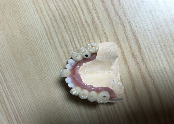 Corona exacta del implante del diente de los accesorios del implante dental de Biocompatibility