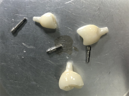 Restauración del implante de zirconia No hay problemas de color