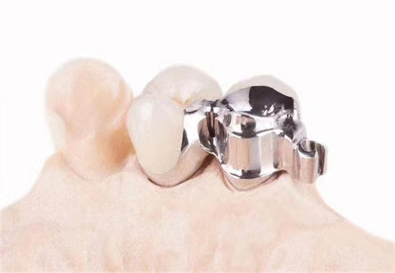 Accesorios de precisión personalizados para clínicas dentales