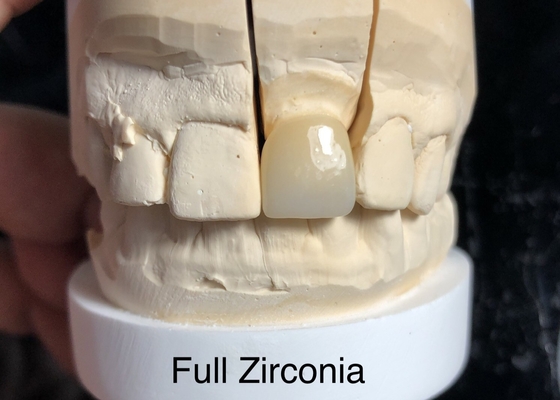 3D de varios niveles de contorno completo Zirconia Solucionar el problema de la falta de transparencia