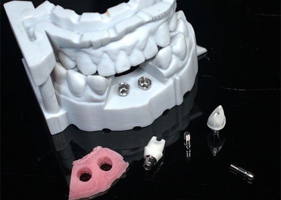 Modelo en 3D Corona de zirconio