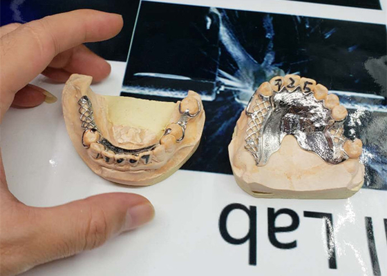 La alta exactitud CAD-CAM fijó diseño desprendible de la numeración del puente