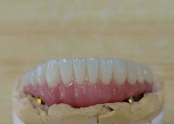 FDA Corona de zirconio con dentaduras con implantes para laboratorio dental