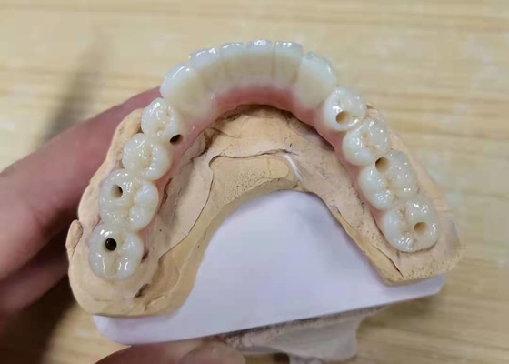 FDA Corona de zirconio con dentaduras con implantes para laboratorio dental