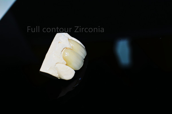 Forma de encargo hermosa fina de la corona de cerámica llena durable de la circona