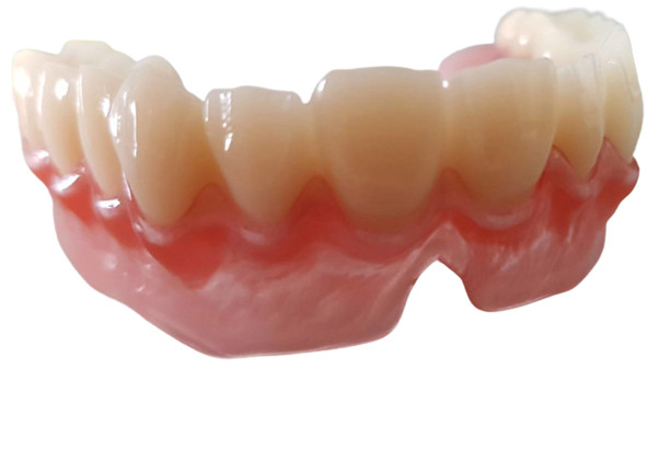 El OEM realista 3D de los datos de Digitaces imprimió los modelos dentales para el dentista Study