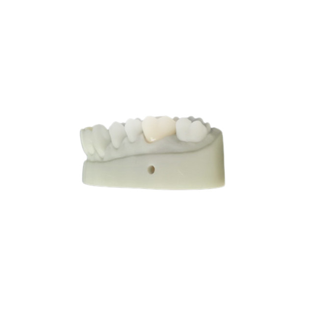 El OEM 3D imprimió el diseño dental de la leva de los modelos cad para el laboratorio de la dentadura