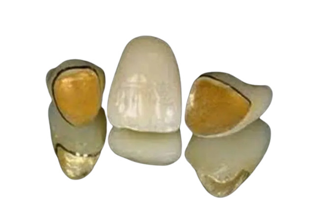 Diseño realista de la numeración del color de PFM del metal de los dientes superficiales lisos de la porcelana
