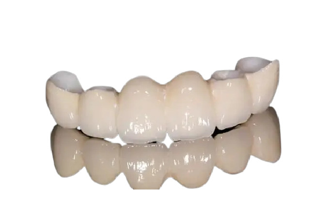 Aspecto natural de la corona dental resistente a la corrosión de la porcelana para Front Teeth/los dientes traseros