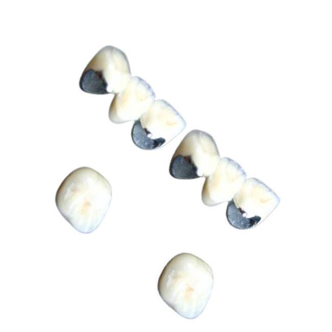 Dientes dentales de la porcelana de Chrome del cobalto de la corona de la porcelana no alérgica resistentes a la corrosión