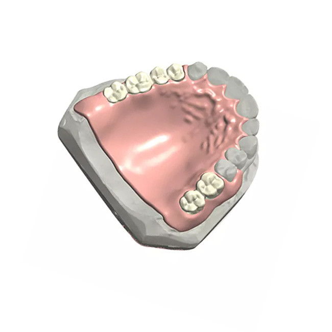 Modelo dental natural Customized del color 3D de la dentadura parcial dental desprendible
