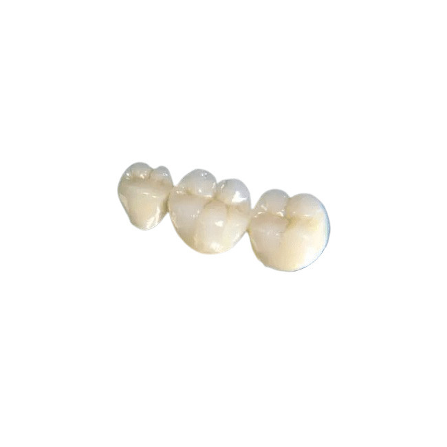 Estabilidad de la corona de la higiene oral buena del puente del cambio del color dental del diente