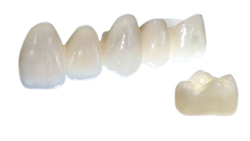 Las coronas de la porcelana son hermosas en la forma realista en color y fuerte en estabilidad