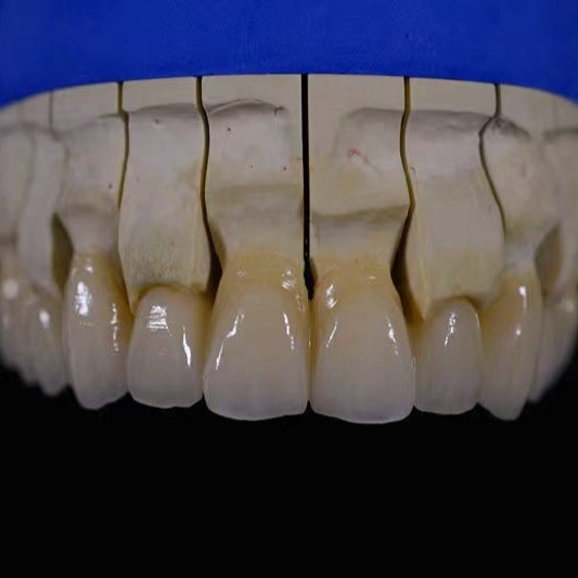 material de porcelana en polvo de porcelana Vita VM9
